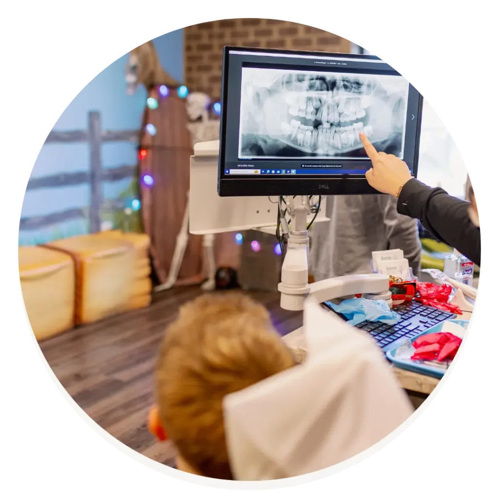 Dental Xrays Sumner Pediatric Dentistry Gallatin Tennessee Nashville Circle
