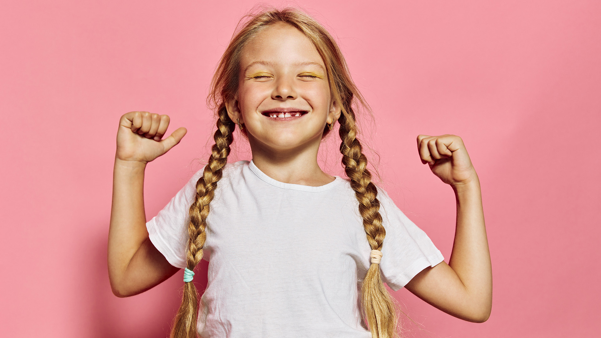 What Is Hypodontia?